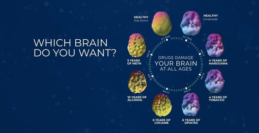Healthy Brain vs. Drug Addiction Brain 