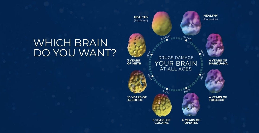 Healthy Brain vs. Drug Addiction Brain 